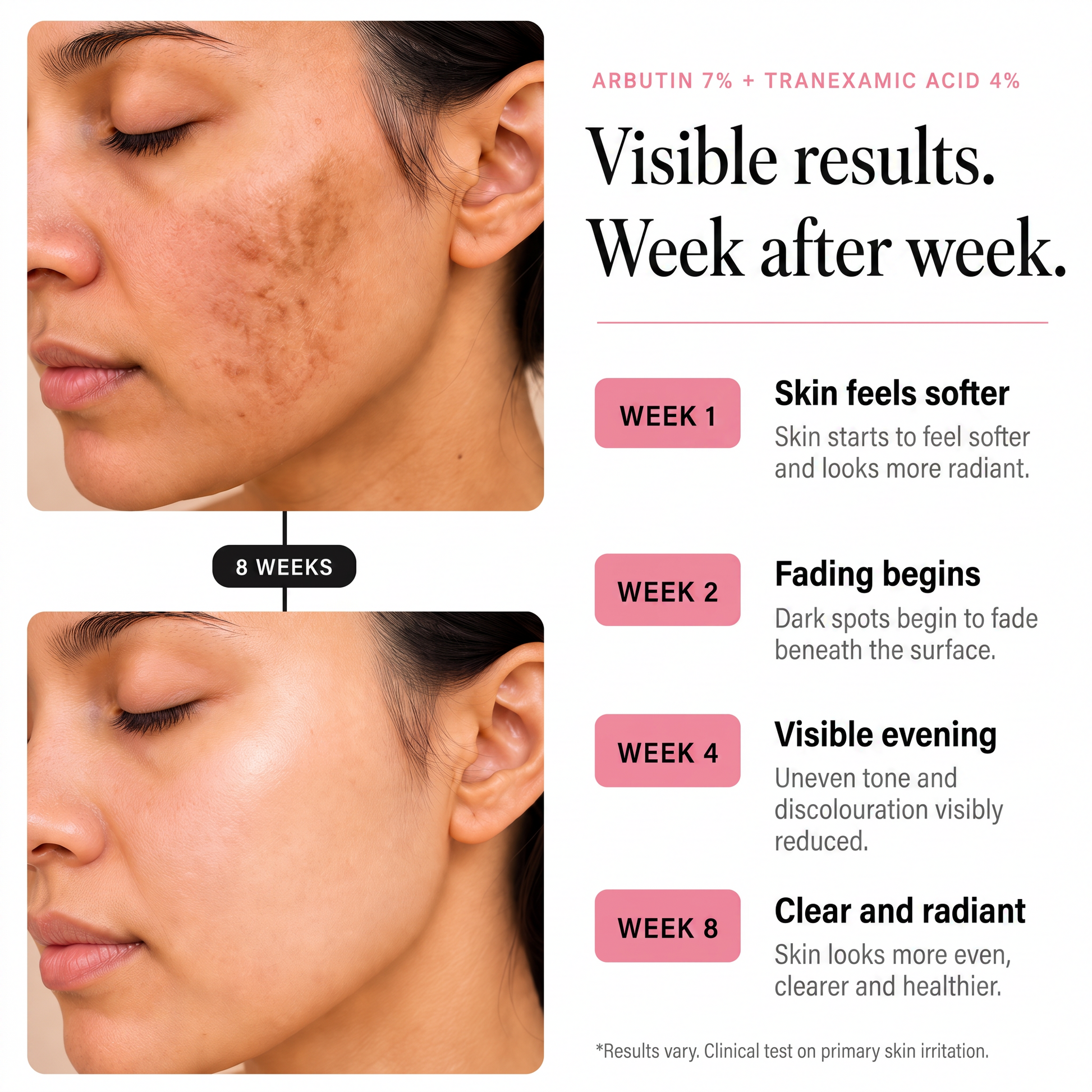 Visible results week after week, from softer skin at week 1 to clear and radiant skin at week 8