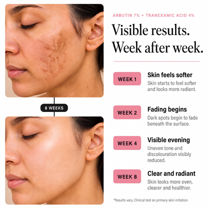 Visible results week after week, from softer skin at week 1 to clear and radiant skin at week 8
